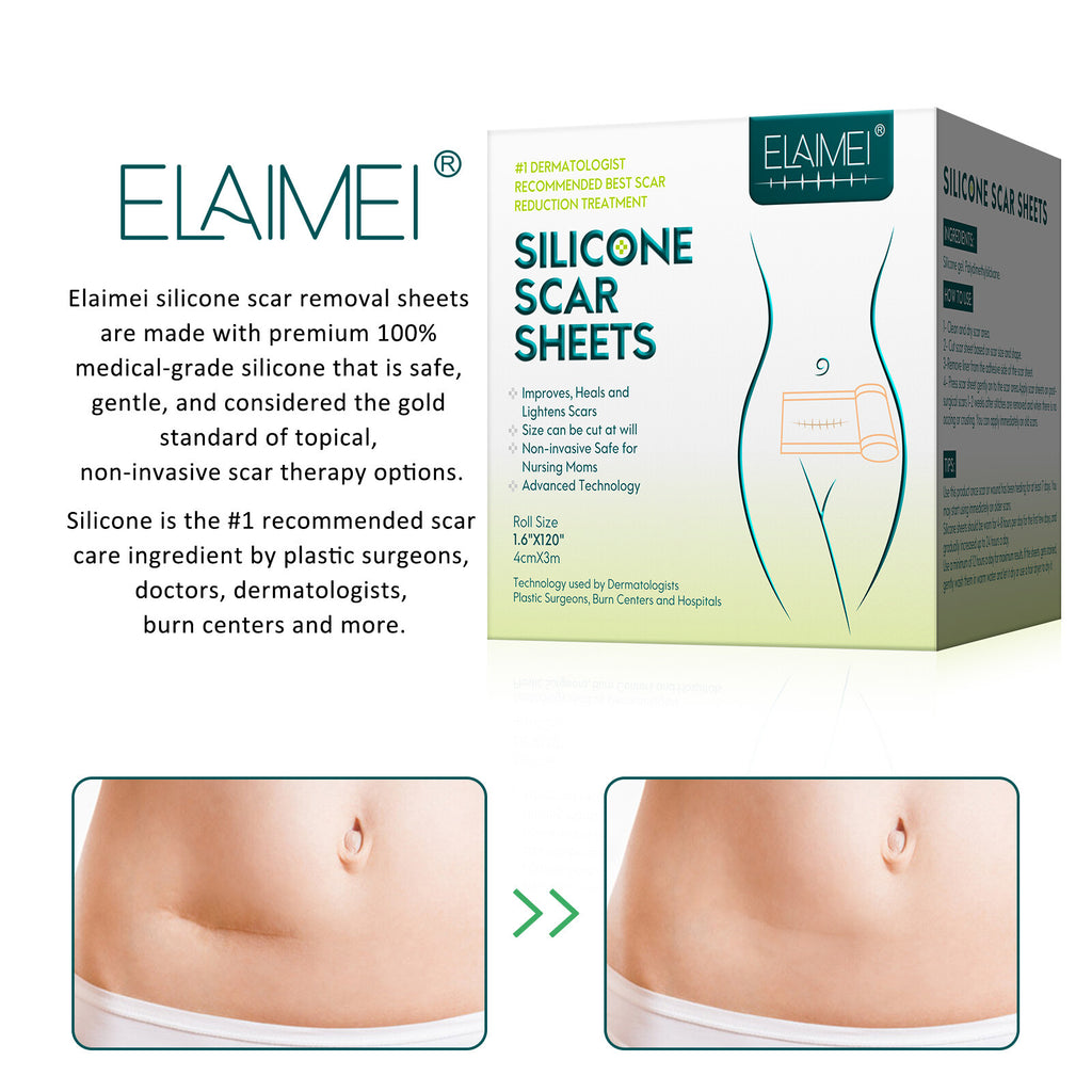 Silicone Scar Removal Tape for Hypertrophic & Keloid Scars - 1.6" x 60-150"