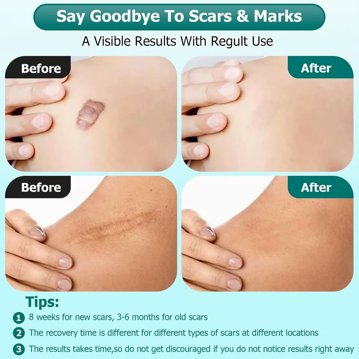 Silicone Scar Gel Cream for Face & Body - 1.76oz Scar & Burn Treatment