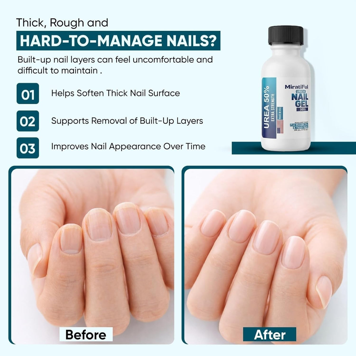Urea 50% Nail Gel for Thick Toenails & Calluses - Softens, Exfoliates, Quick-Dry, 1 fl oz
