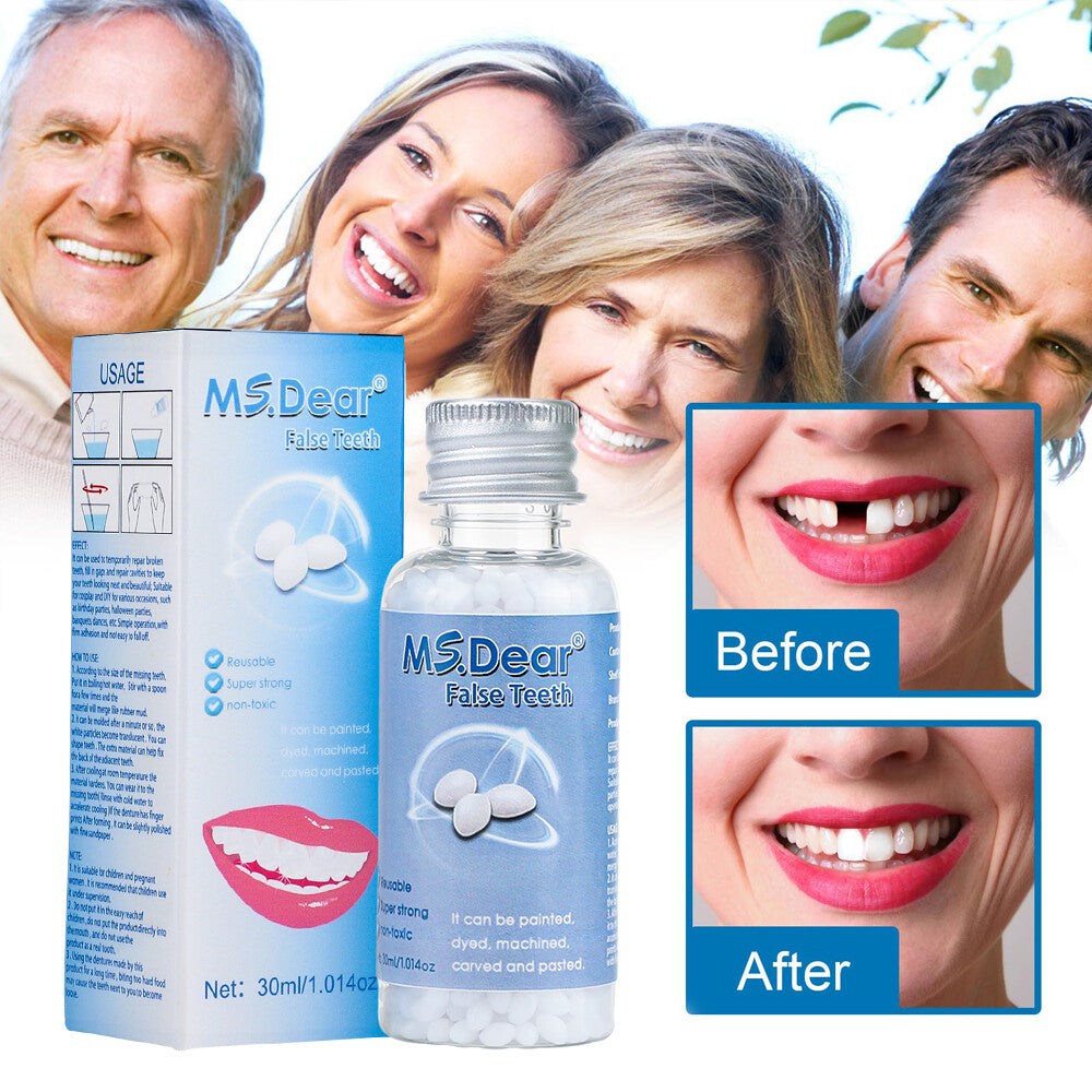 Tooth Repair Kit - Temporary Dental Restorations for Missing & Broken Teeth