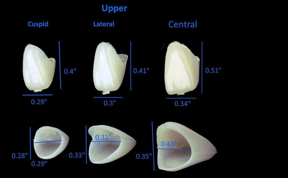Dental Temporary Crown Kit - 100 Mixed Anterior & Molar Crowns for Restorations