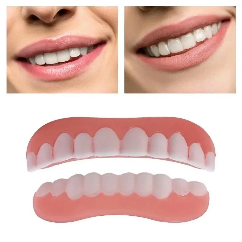 Upper and Lower Snap-On Dental Veneers Set - False Teeth Cover