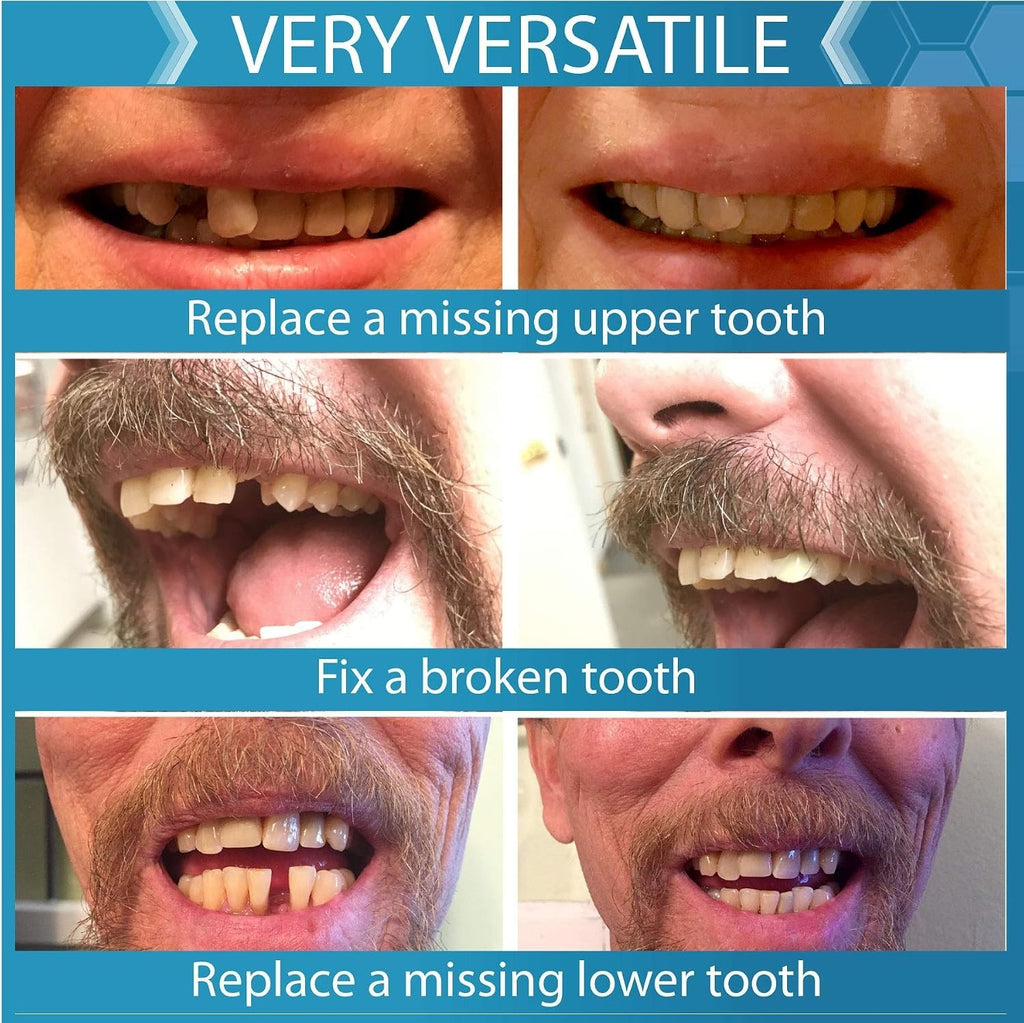 Adult Smile Restoration Kit with 40 Thermal Fitting Beads & Shades