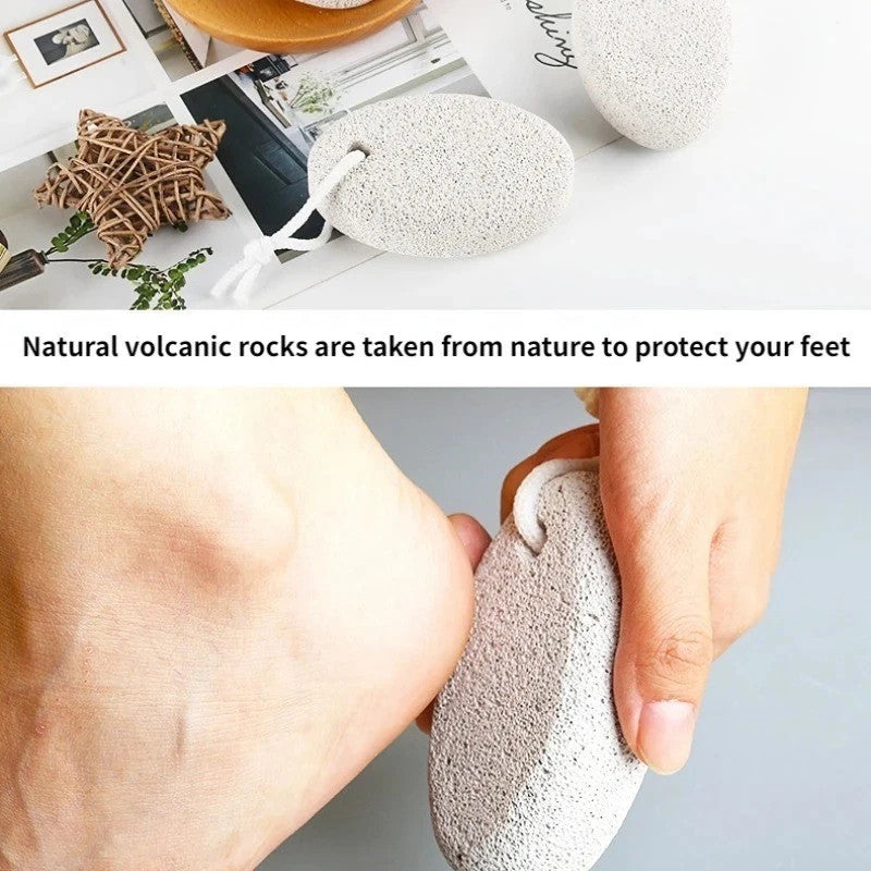 Foot Callus Remover Pedicure Tool - Dead Skin Exfoliator for Smooth Feet