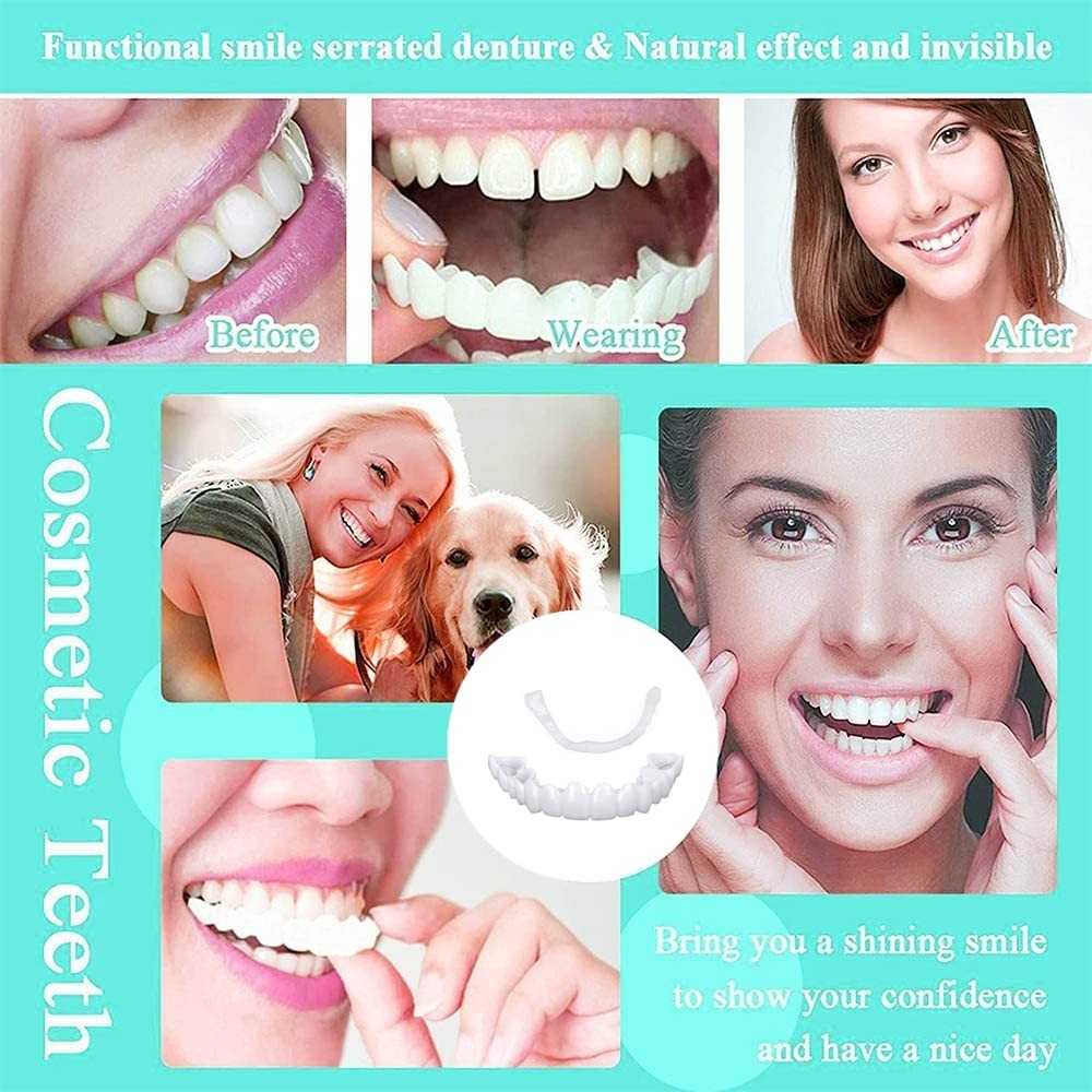Dental Veneers & Denture Covers Set - Reusable Food-Grade Silicone, Cosmetic & Orthodontic Use