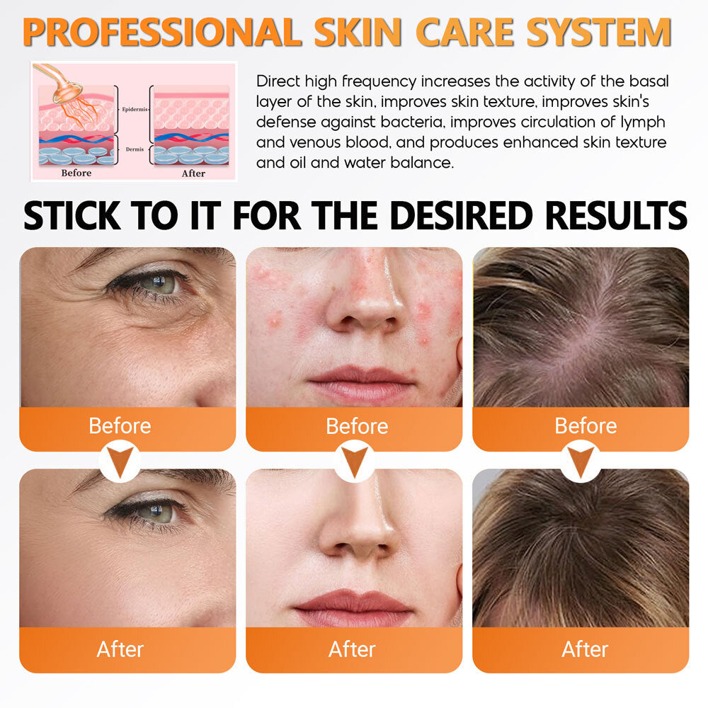 High Frequency Facial Wand for Skin Tightening & Acne Treatment - Portable Handheld Device