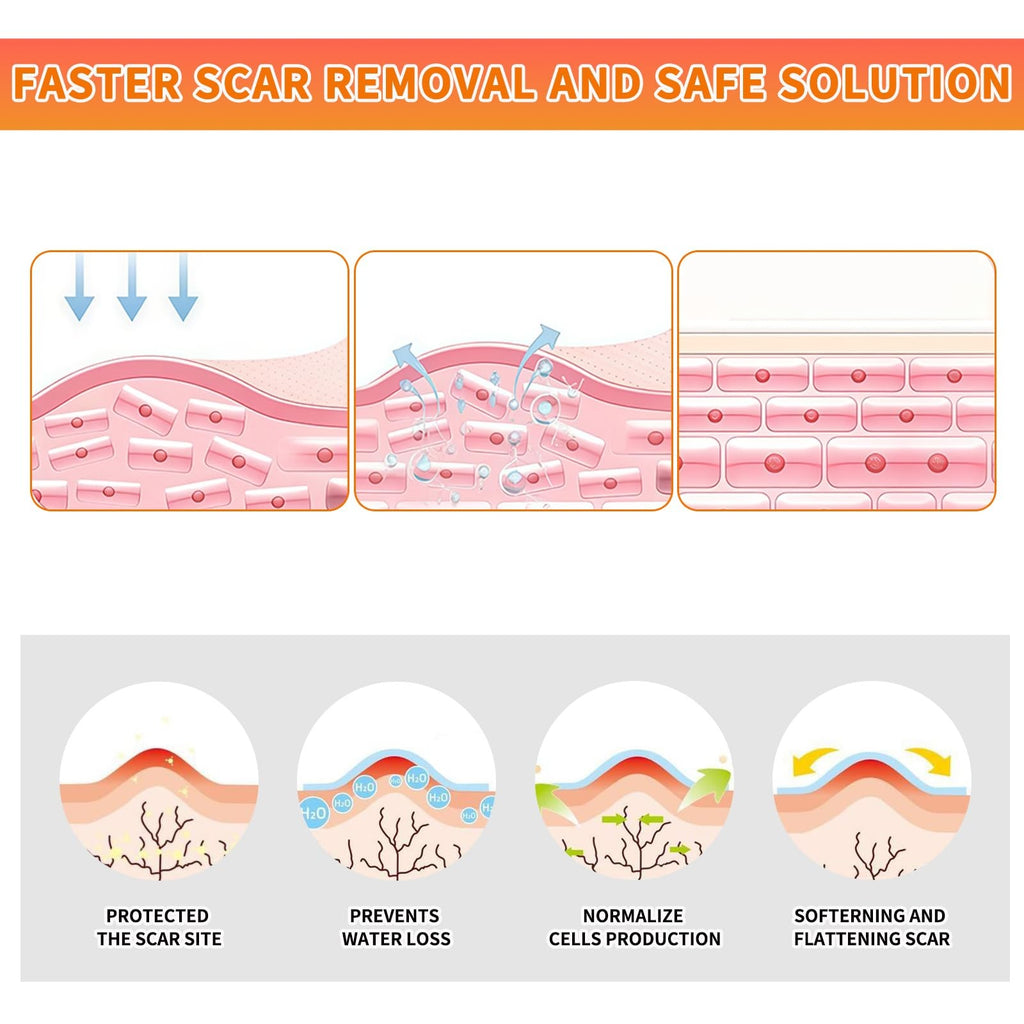 Silicone Scar Sheets Roll 1.6x60 Inches Medical Tape for Scar Removal