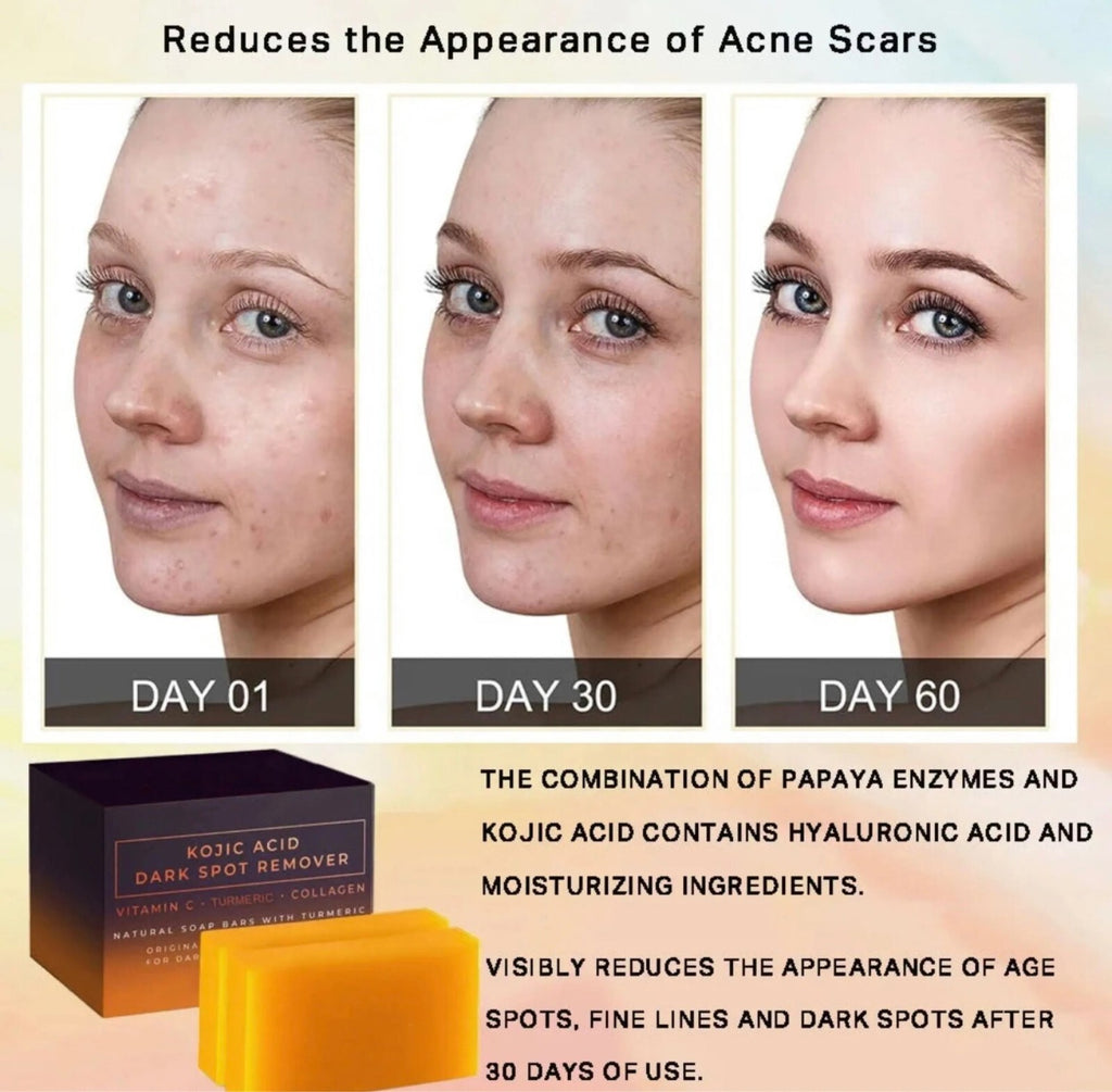 Kojic Acid Dark Spot Corrector Soap Bars with Vitamin C & Collagen - 2 Pack