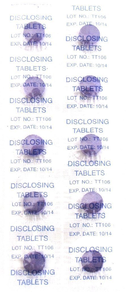 Disclosing Plaque Tablets Set of 5 - Oral Hygiene &