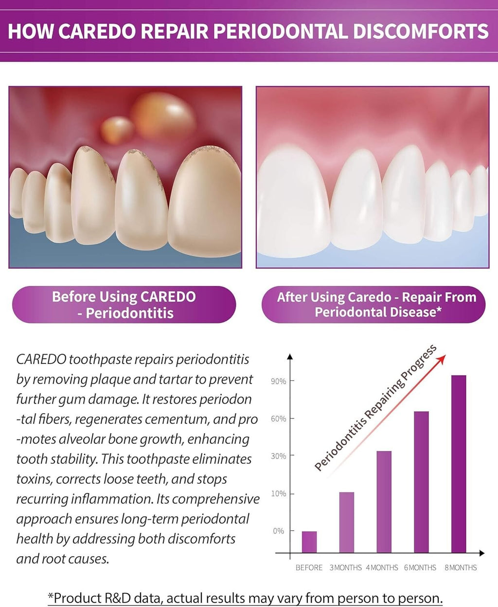 Professional Gum Disease Toothpaste for Receding Gums & Loose Teeth