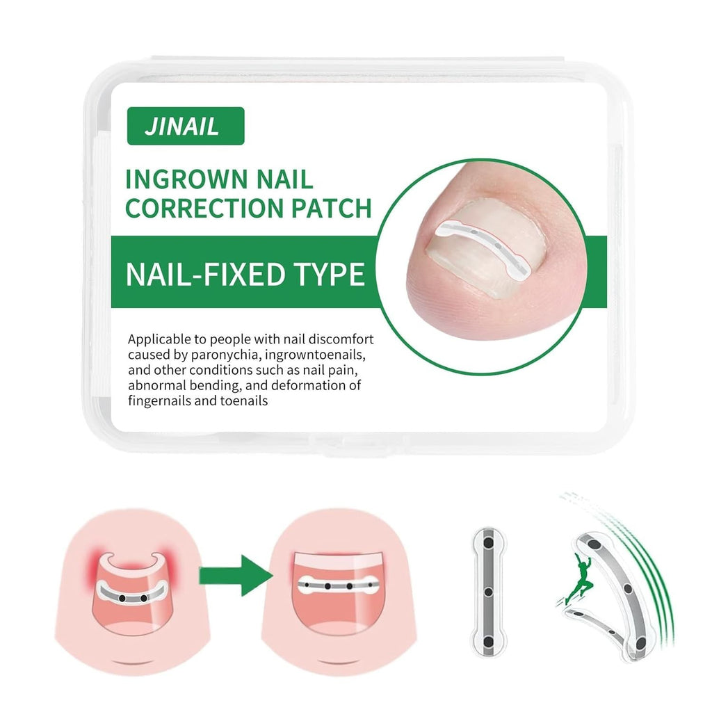 Ingrown Toenail Correction Patch Kit - Nail Fix & Deformation Treatment