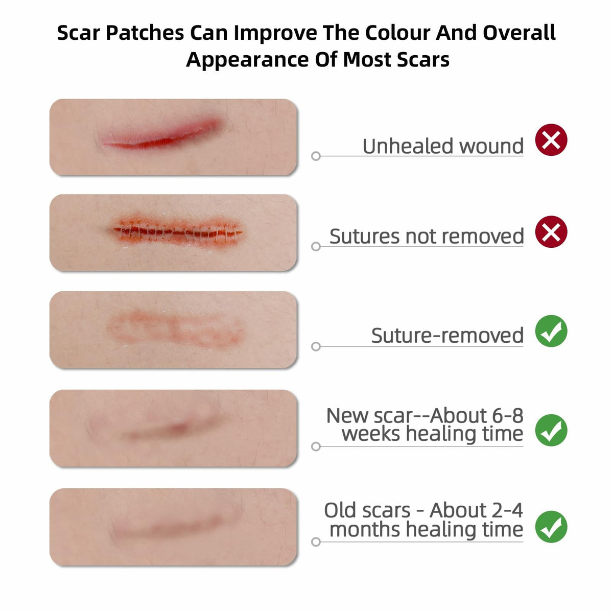 Reusable Silicone Scar Tape Roll 1.6” x 120” for C-Section & All Scars