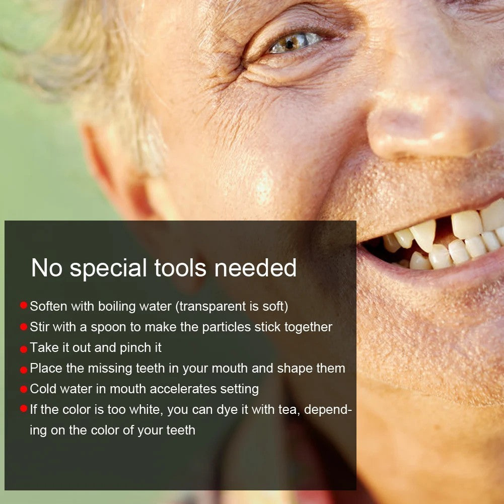 Temporary Tooth Repair Beads Kit for Broken & Missing Teeth - DIY Dental Filling Material