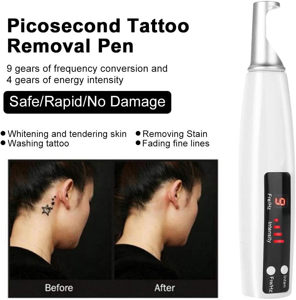 Rechargeable Laser PicoSecond Plasma Pen for Freckle Removal with Red Light Therapy