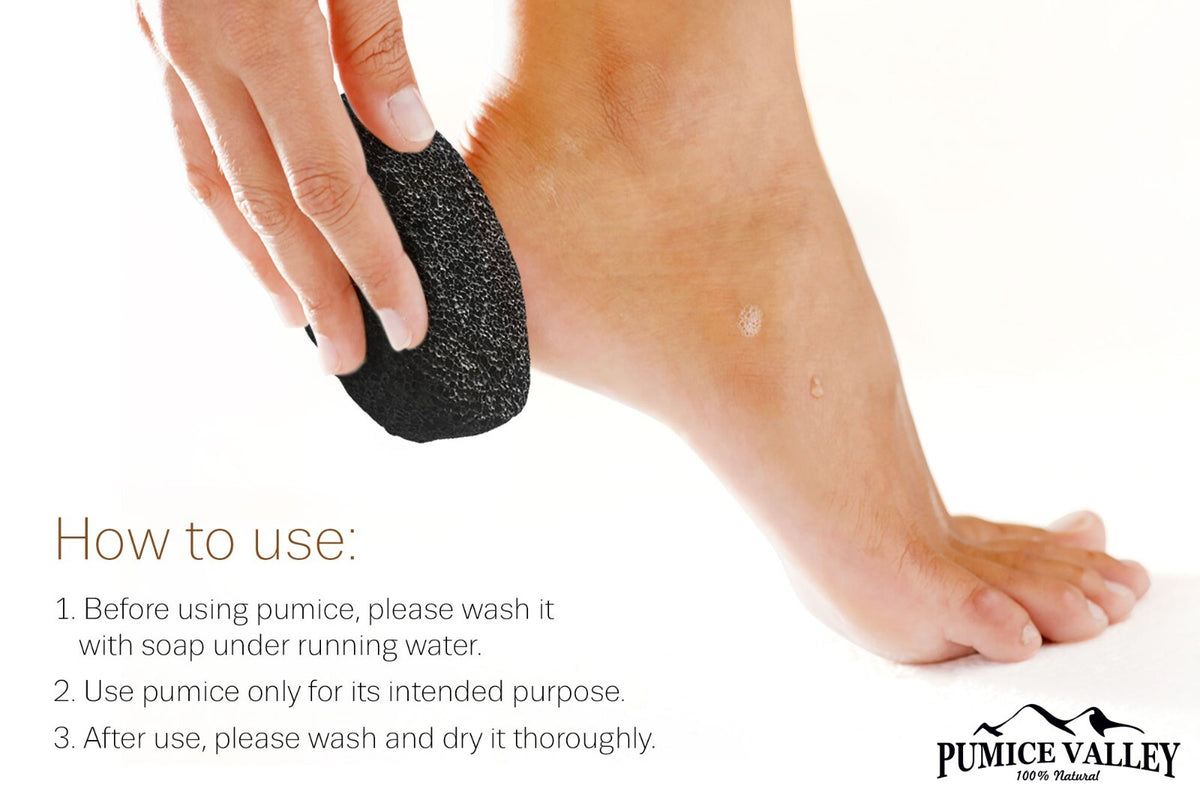 Pumice Stone for Feet and Callus Removal - Foot File and Skin Scrubber
