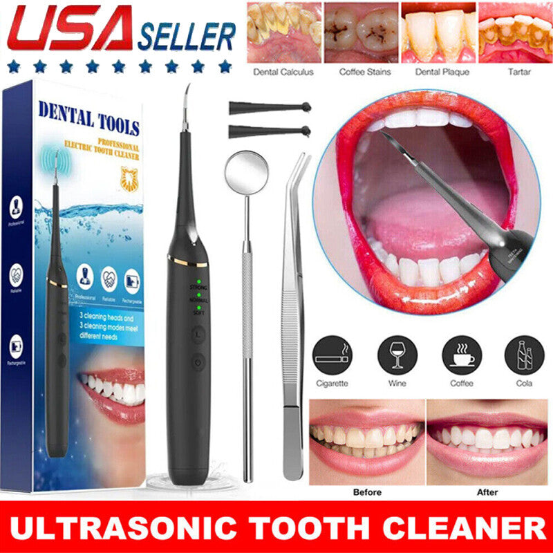 Ultrasonic Tooth Cleaner Plaque & Tartar Remover - Rechargeable Dental Scanner