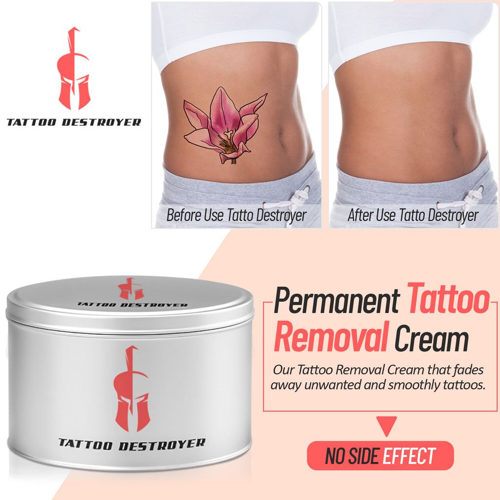 Tattoo Removal Cream – Painless Maximum Strength Fading Solution