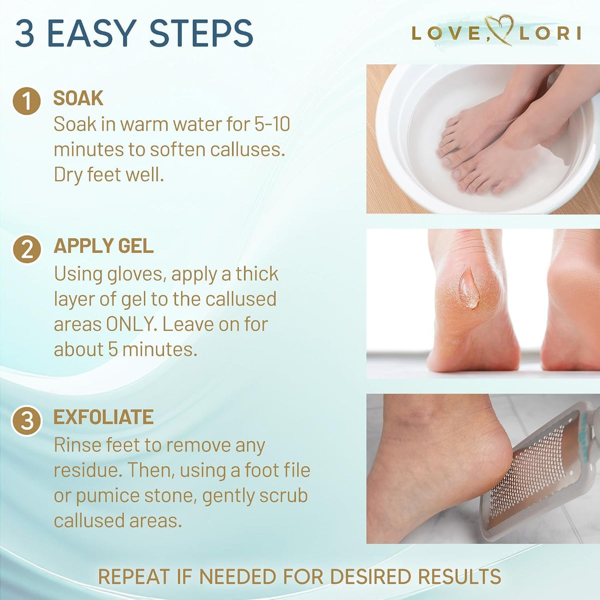 Extra Strength Foot Callus Remover Gel for Smooth Feet – 6Oz
