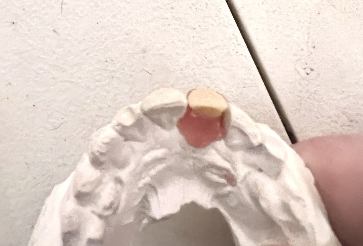 Missing Tooth Kit for Front Teeth Replacement Acrylic Teeth Set - A2 Shade