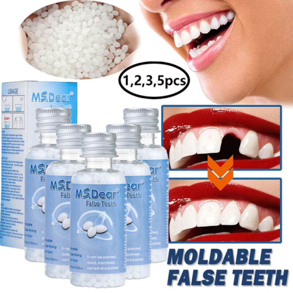 Reusable Moldable Tooth Repair Kit - Temporary Beads for Broken Gaps