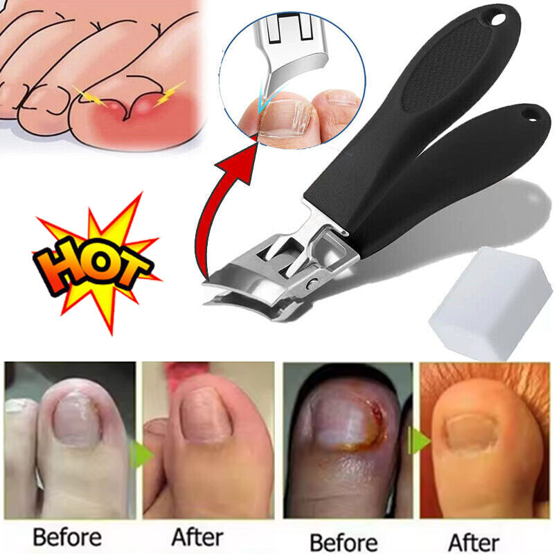 Wide Jaw Opening Anti-Splash Curved Nail Clipper - Safe & Precise Trimming