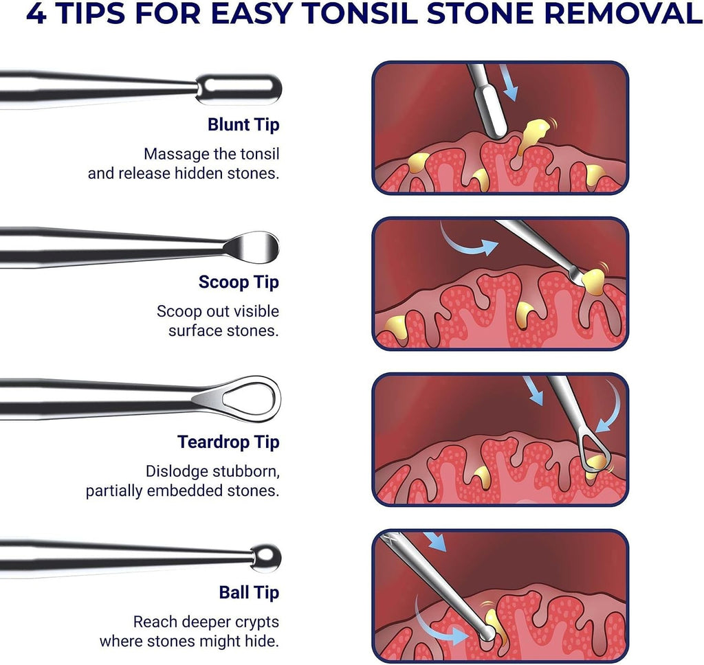 Tonsil Stone Removal Kit with Stainless Steel Picks & Silicone Tips - Safe Oral Hygiene Tool