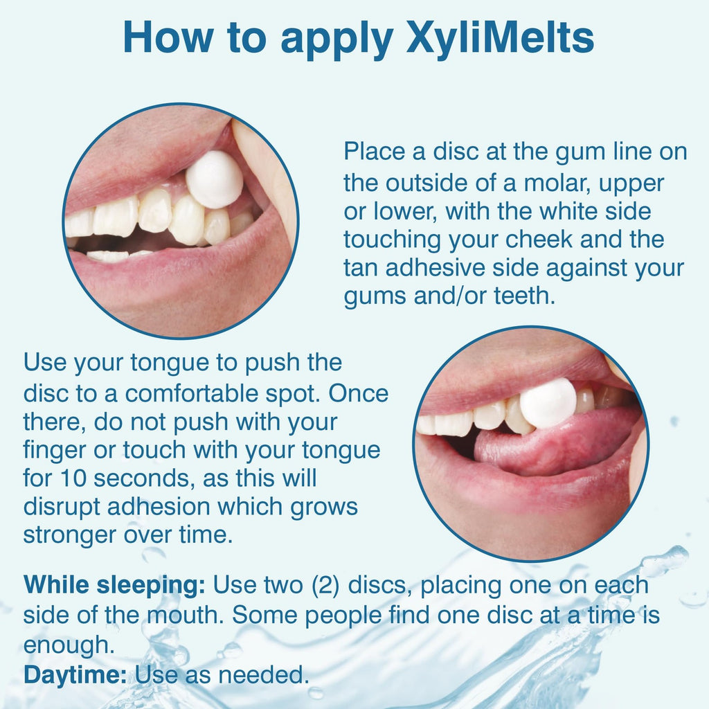Dry Mouth Relief Discs - XyliMelts Mint Flavor, 230 Count, Long-Lasting