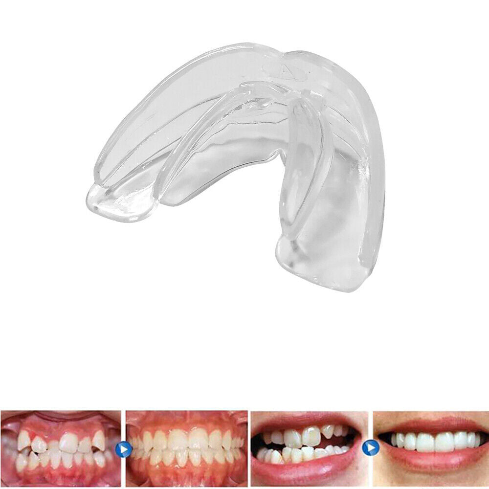 Dental Mouth Guard for Bruxism TMJ Sleep Aid Night Teeth Grinding Protector