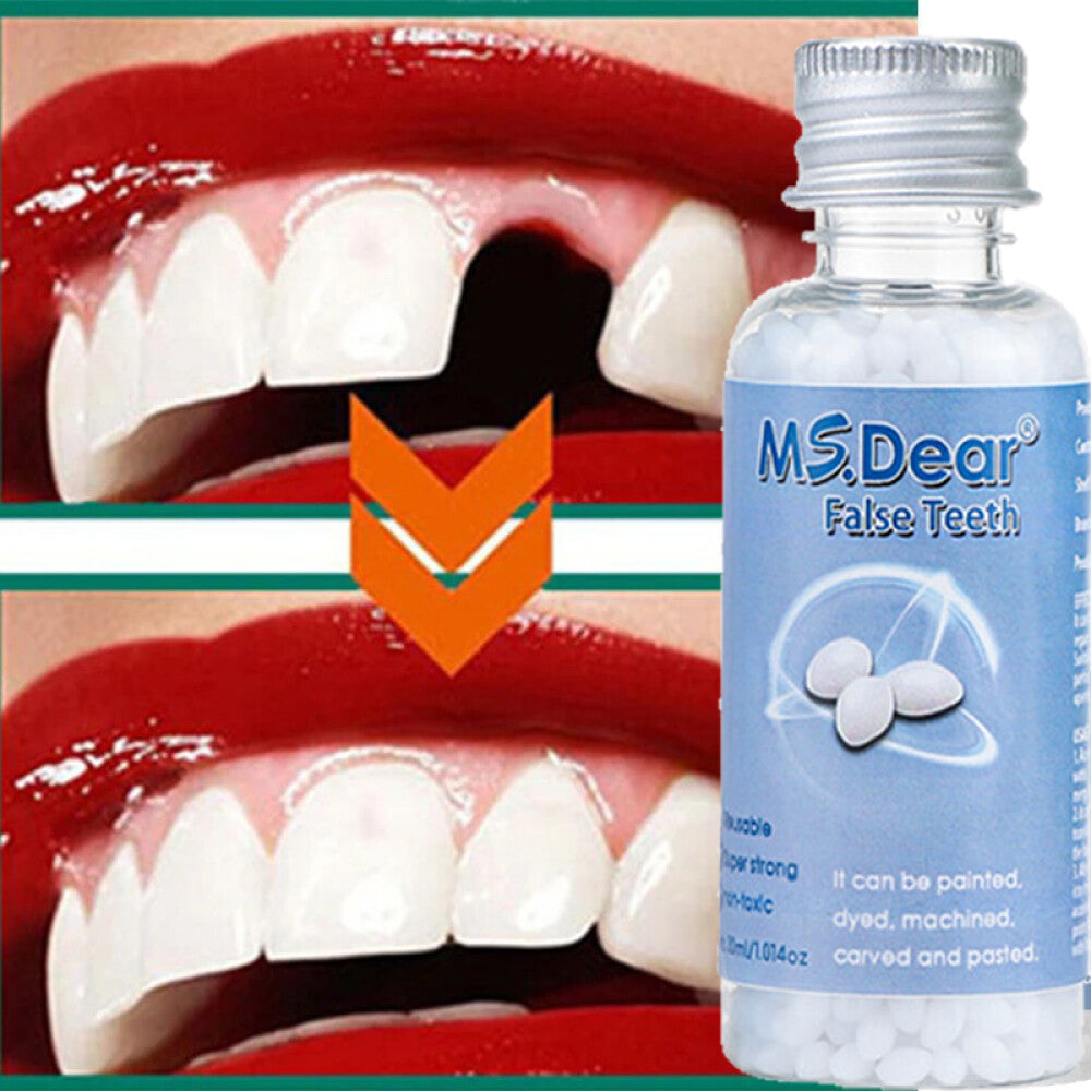 Moldable Resin Tooth Gap Filler & Temporary Dental Repair Glue 30ml