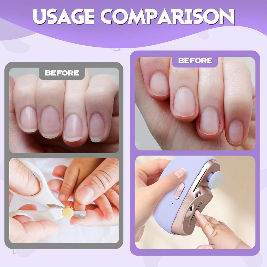 Electric Nail Clipper & File Set with Polishing and Debris Organizer