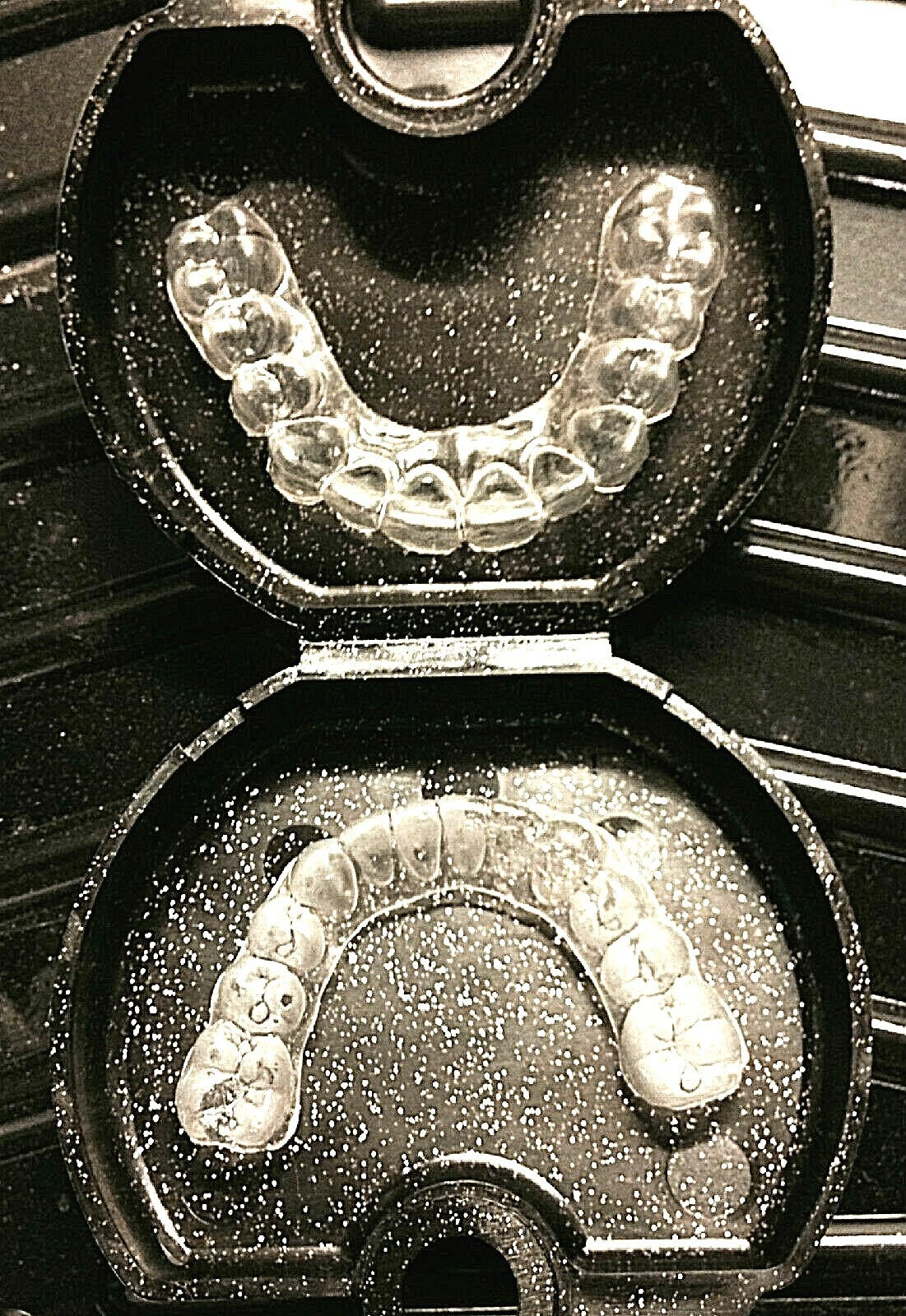Custom Fit Dental Retainer Set - Upper and Lower Made in USA