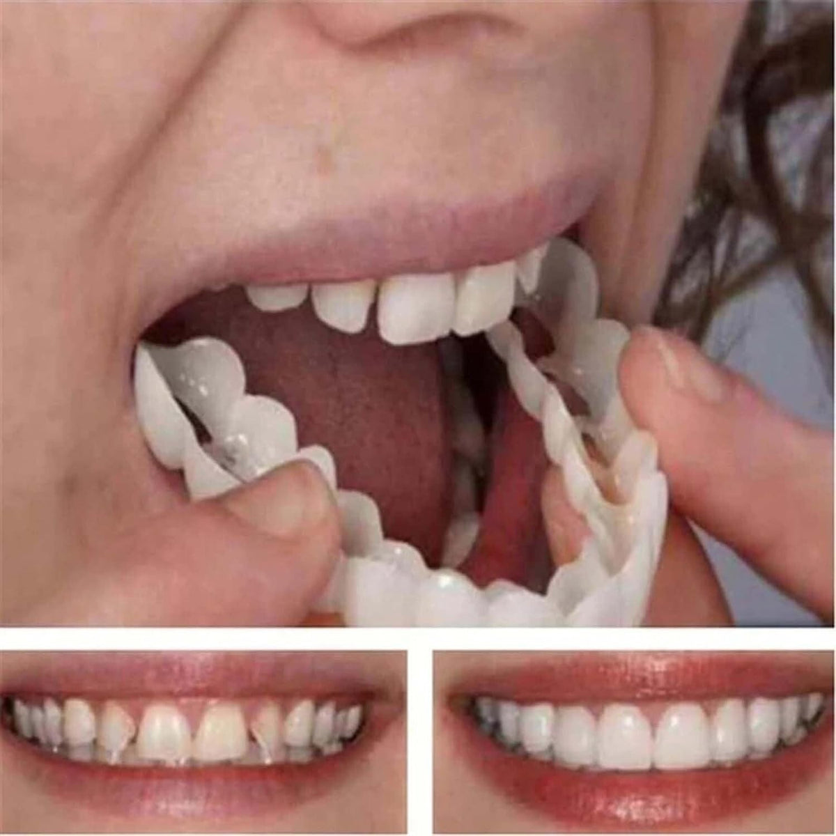 Snap-On Veneers Fake Teeth Kit for Women and Men - 2 Pack Smile Enhancer