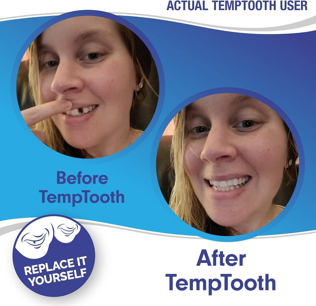 Temporary Tooth Replacement Kit - DIY Natural Smile Repair