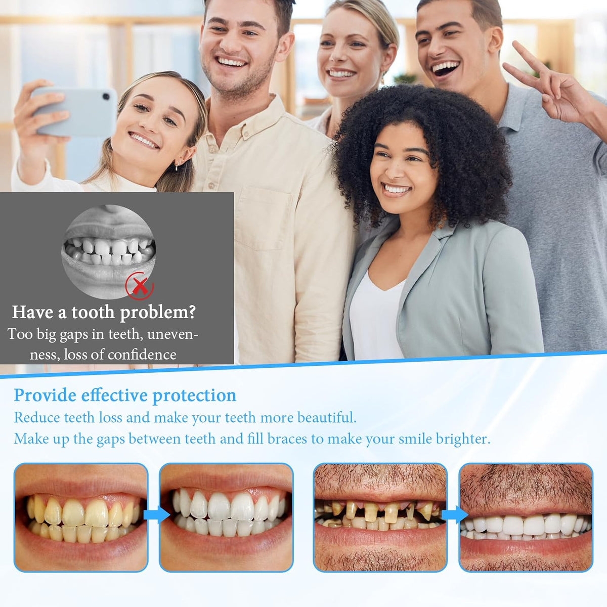 Snap-On Veneers for Men and Women - Natural Look Teeth Enhancer, Portable & Easy to Use