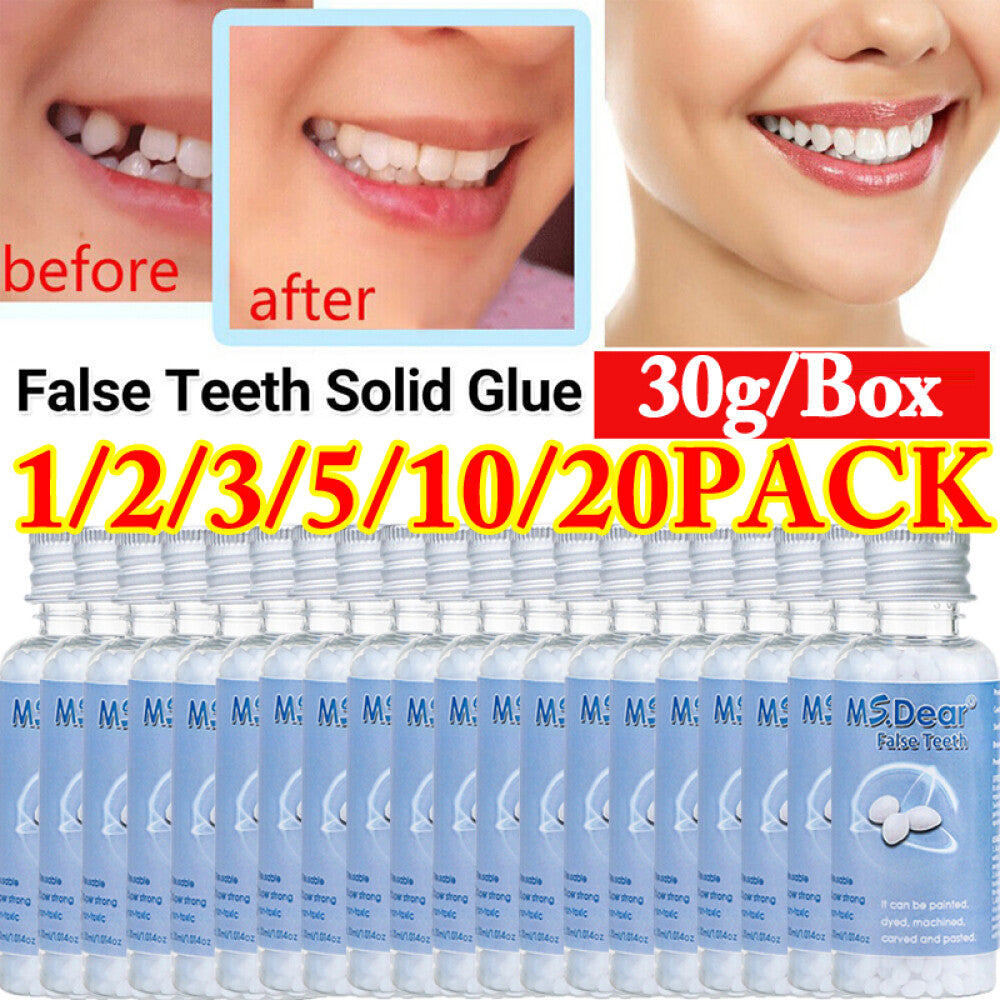 Temporary Teeth Repair Glue for Gaps & Broken Teeth - Moldable Resin