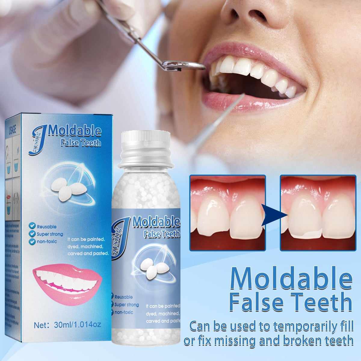 Dental Restoration Kit Moldable Bead for Filling and Repair - All Variants