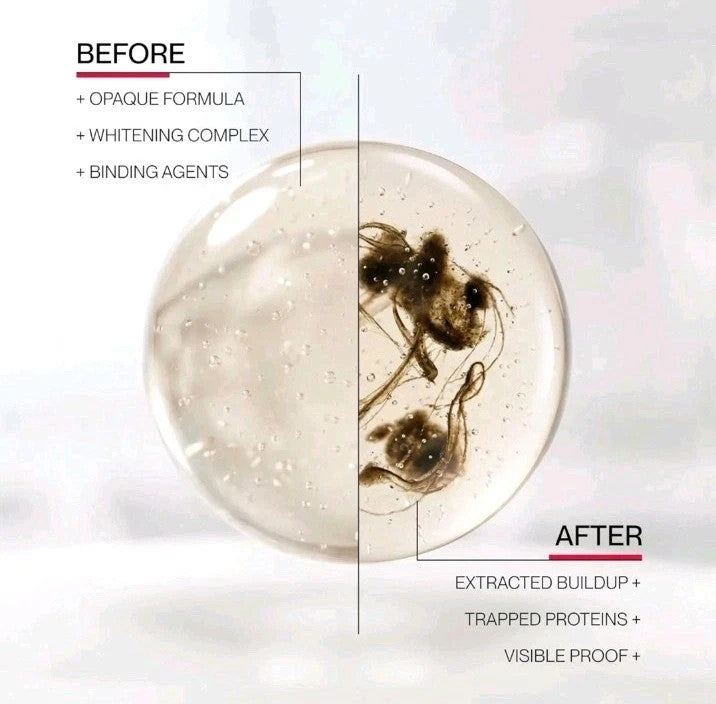 Whitening Mouthwash with Peroxide for Fresh Breath and Surface Stain Removal