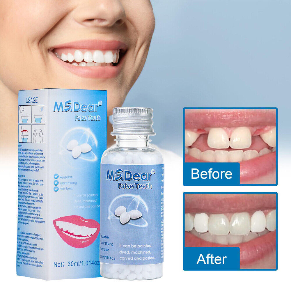 Temporary Dental Repair Kit for Broken Teeth & Cavities - Reusable Teeth Filler