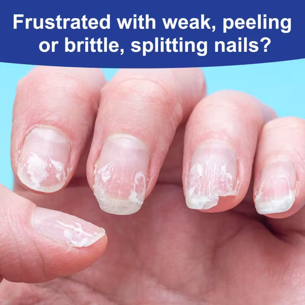 3-Pack Nail Care Oil with Keratin & Amino Acids for Strong, Hydrated Nails