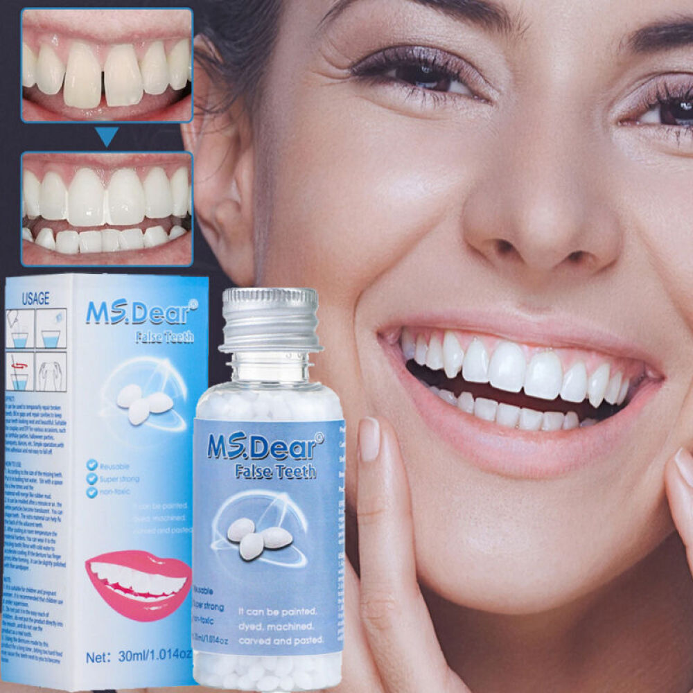 Reusable Moldable Tooth Repair Kit - Temporary Beads for Broken Gaps