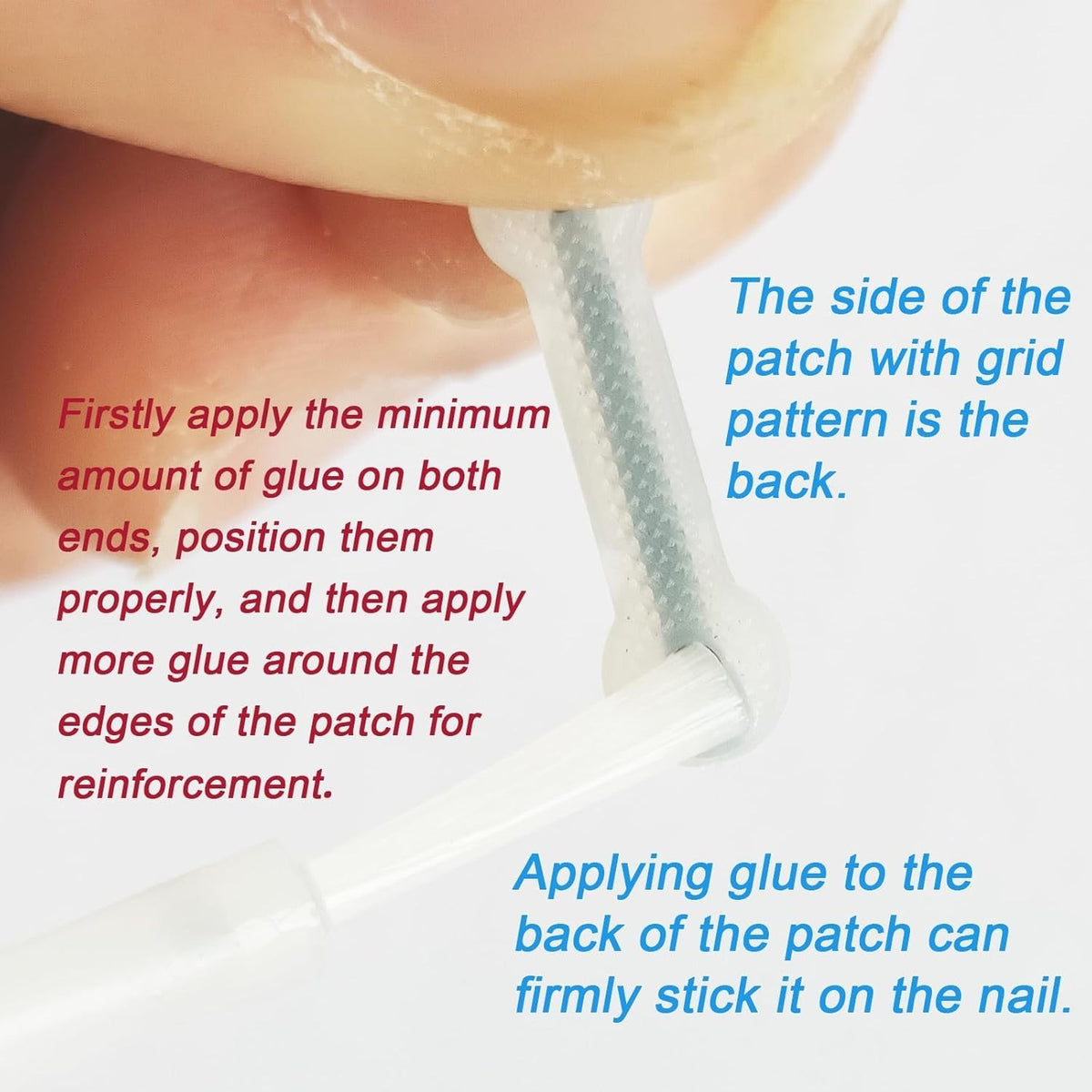 Ingrown Toenail Correction Patch Kit - Nail Fix & Deformation Treatment