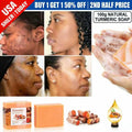 Turmeric & Ginger Skin Whitening Soap for Dark Spots Acne Brightening Natural