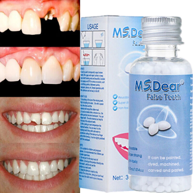 Reusable Moldable Tooth Repair Kit - Temporary Beads for Broken Gaps
