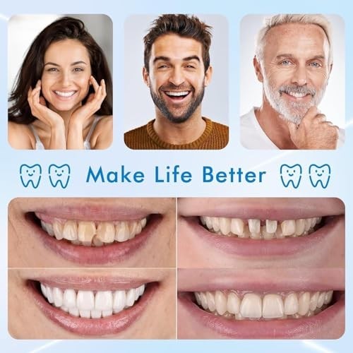 Moldable Silicone Denture Set - Comfortable Fake Teeth & Veneers
