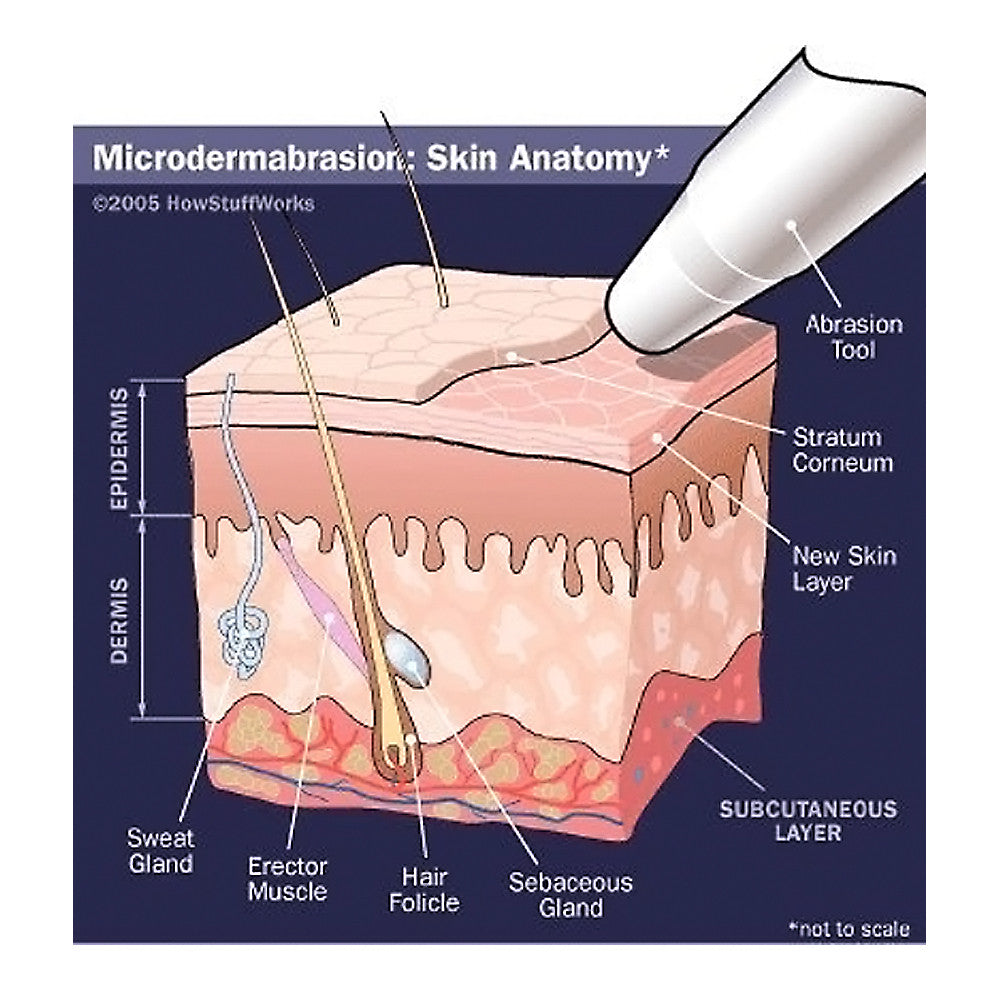 Microdermabrasion Crystals 4 lb / 1.8 kg - 100 Grit Natural Face Exfoliator
