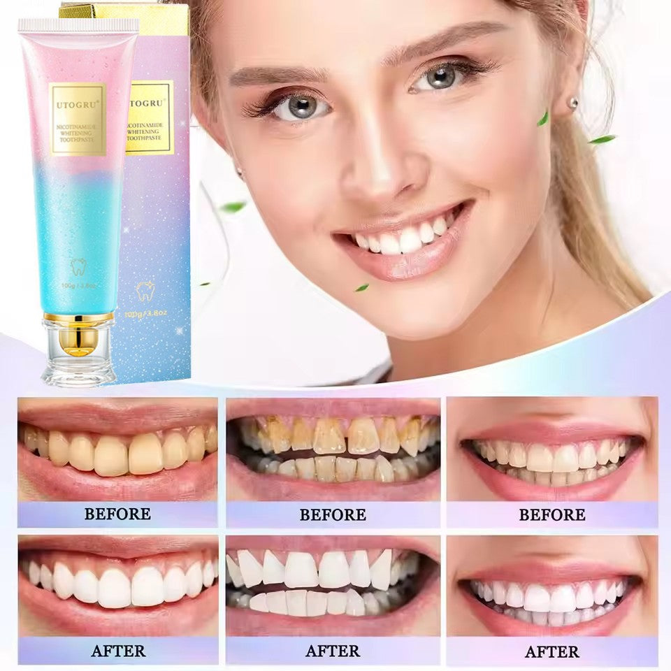 Nicotinamide Whitening Toothpaste with Fresh Mint - 100g - Brighten & Strengthen Enamel