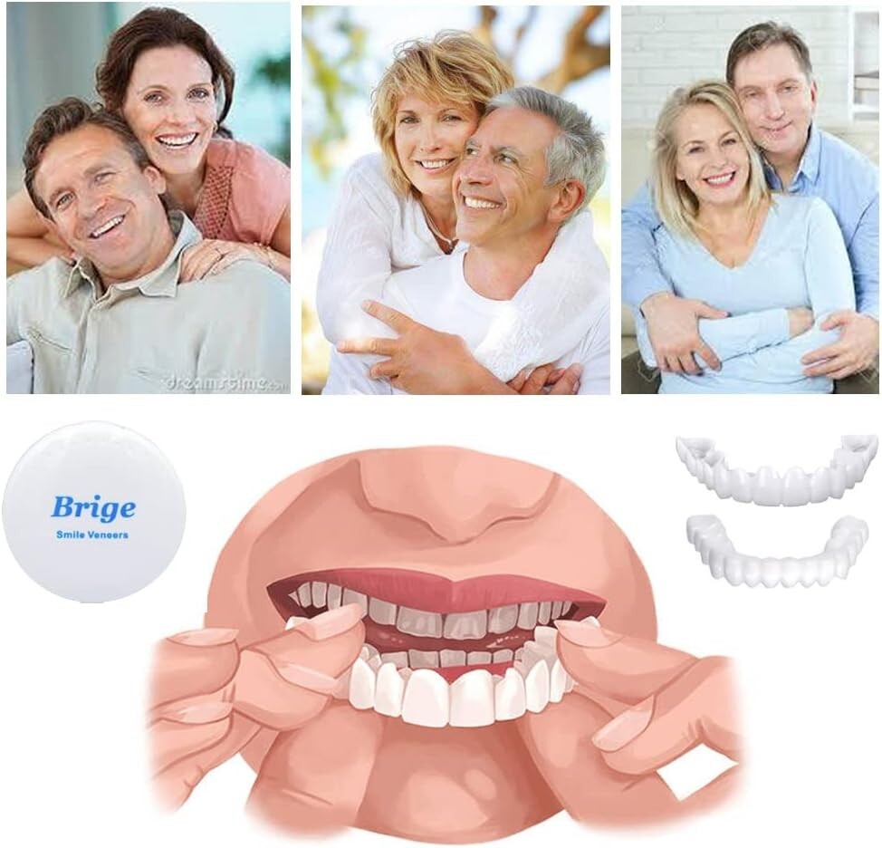 Instant Fake Teeth Smile Set - 2 Upper Dentures for Temporary Confidence