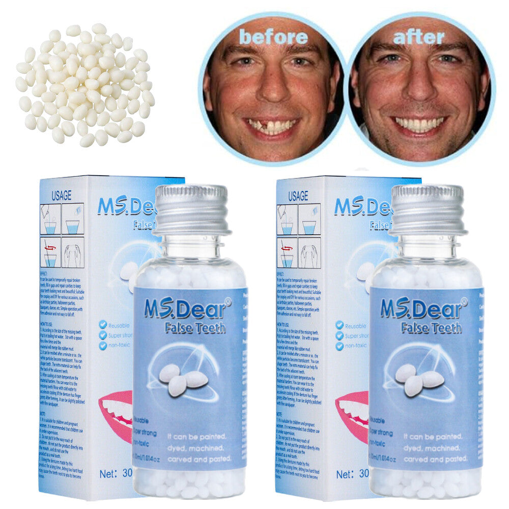 Teeth Thermal Fitting Beads Set for Temporary Tooth Repair & DIY Moldable Veneers