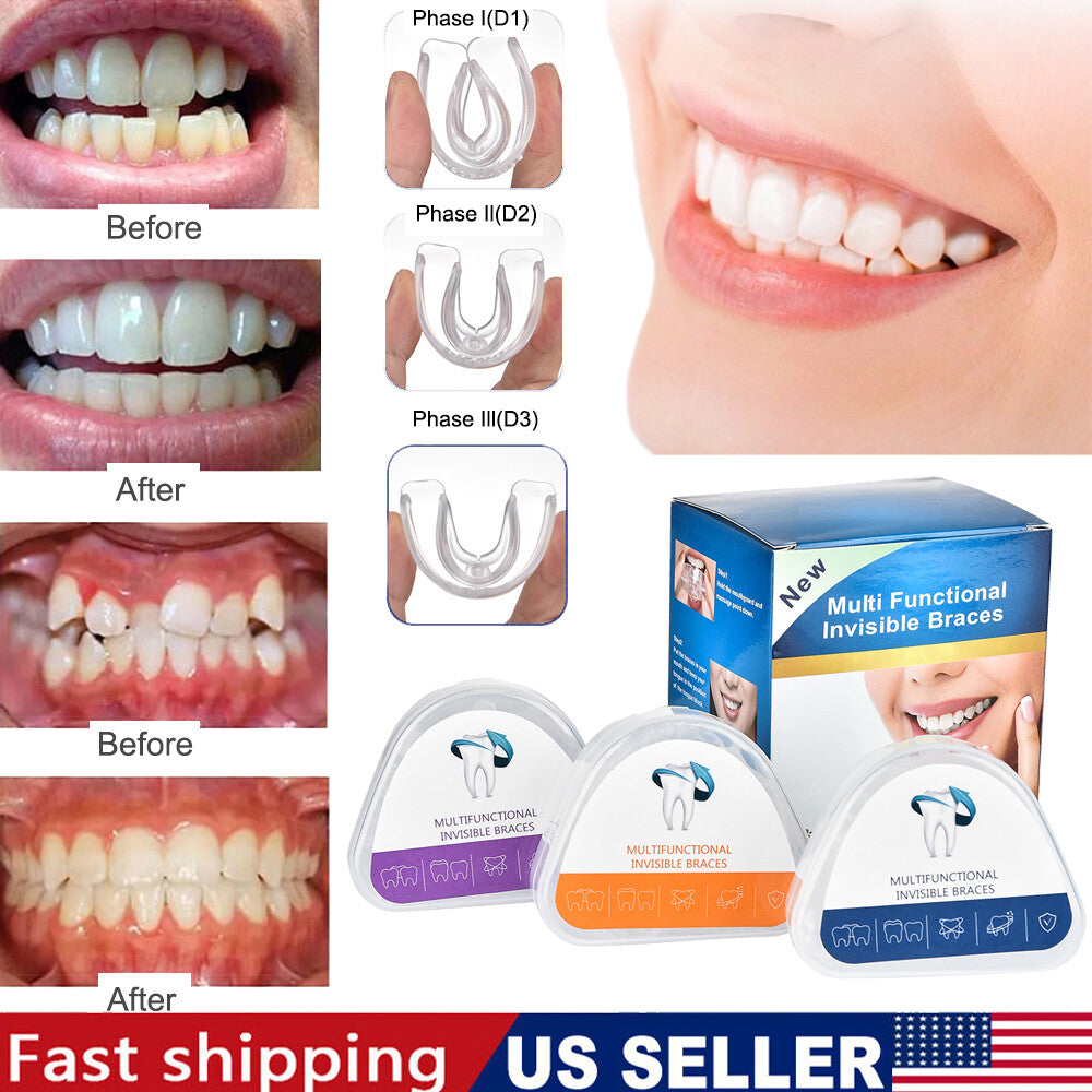 Adult Teeth Aligners Orthodontic Braces Trainer for Dental Alignment - 3-Stage Set