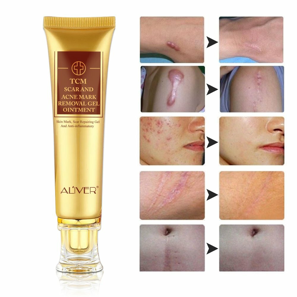 Scar and Acne Mark Removal Gel for Skin Blemish Healing – Multiple Packs
